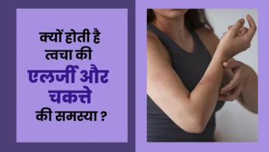 त्वचा की एलर्जी और चकत्ते का कारण क्या है? , हिंदी में त्वचा की एलर्जी और चकत्ते का क्या कारण बनता है | हिंदी में त्वचा की एलर्जी और चकत्ते का क्या कारण है