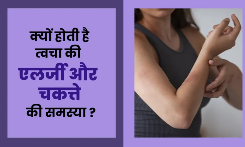 त्वचा की एलर्जी और चकत्ते का कारण क्या है? , हिंदी में त्वचा की एलर्जी और चकत्ते का क्या कारण बनता है | हिंदी में त्वचा की एलर्जी और चकत्ते का क्या कारण है