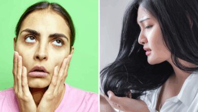 एक सप्ताह में स्वाभाविक रूप से स्वस्थ त्वचा और बाल कैसे प्राप्त करें, बाल कम हो जाएंगे ... चेहरे वापस आ जाएगा! बस मान लें कि डॉ। डॉ। टॉक, 8 वें दिन से देखा जाएगा - कैसे स्वस्थ त्वचा और बाल प्राप्त करें स्वाभाविक रूप से डॉक्टर सुधानसु राय ने दैनिक का पालन करने के लिए स्वस्थ जीवन शैली के सुझाव दिए